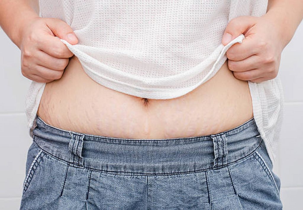 Shed Stomach Fat